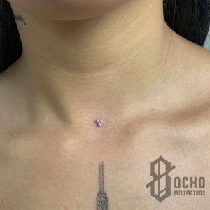 Microdermal